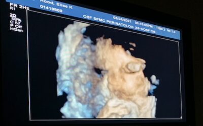 Baby Fulton’s 39 week ultrasound video