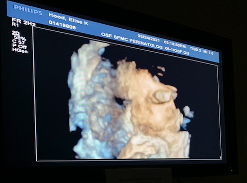 Baby Fulton’s 39 week ultrasound video