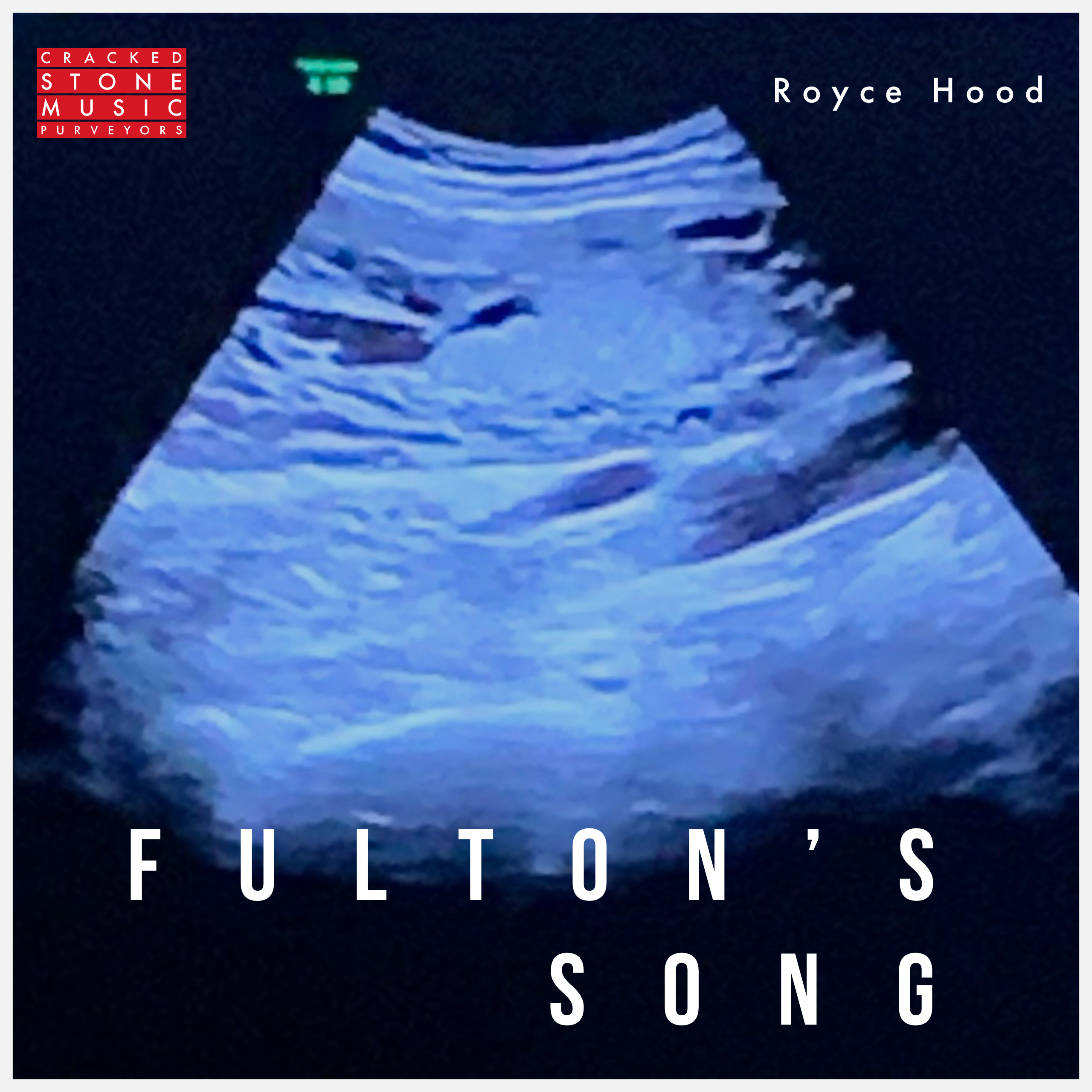 Hear Fulton’s Song Now!